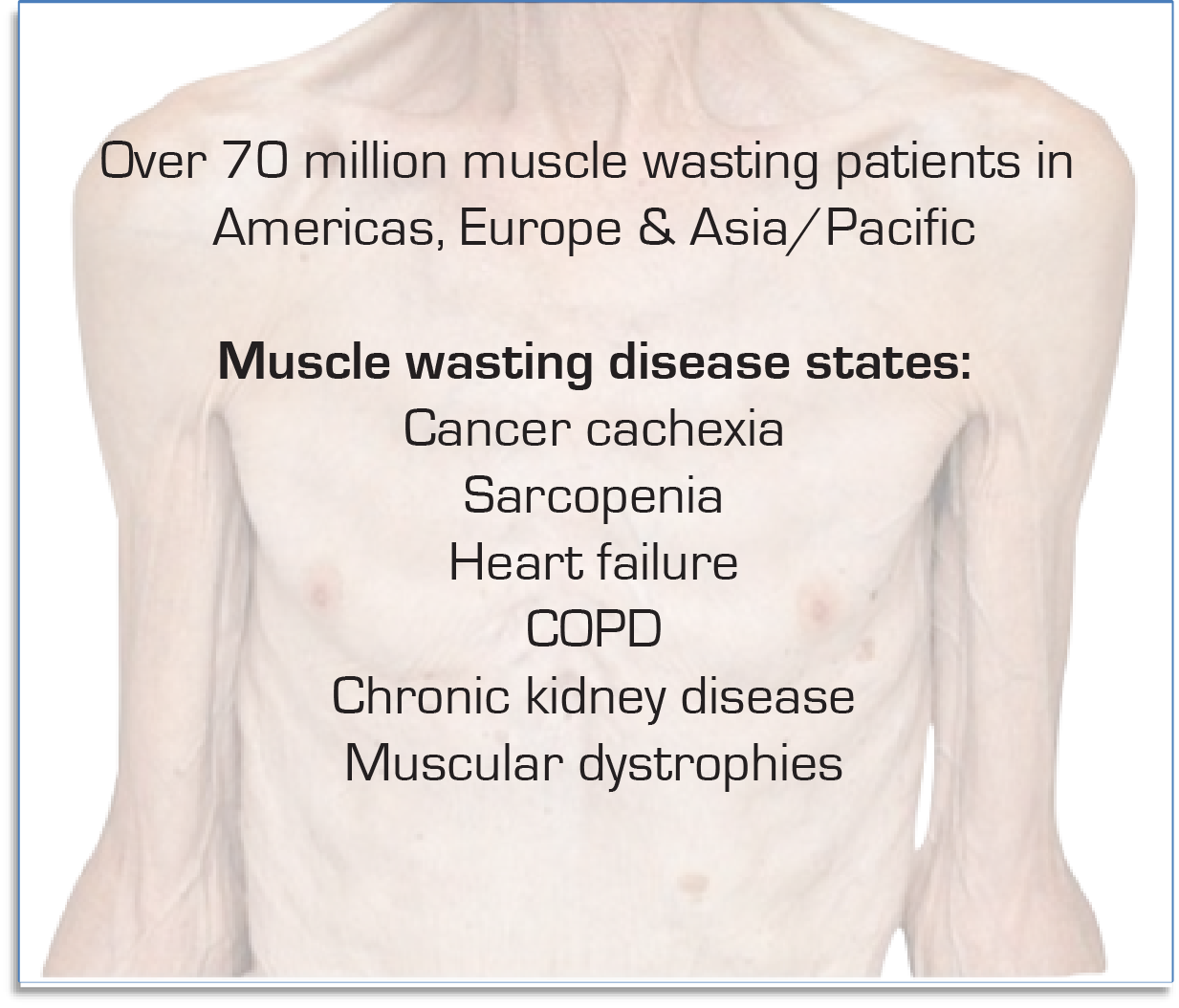 muscle wasting